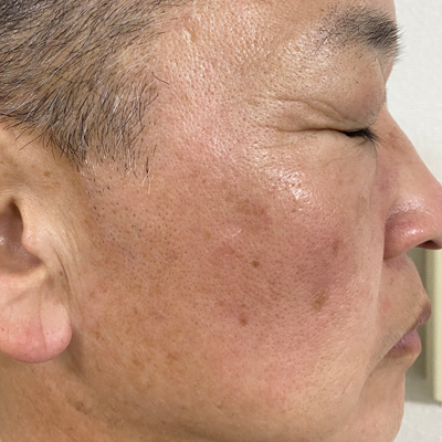 Dr.PUR BEAUTEご利用前