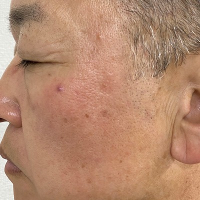 Dr.PUR BEAUTEご利用前