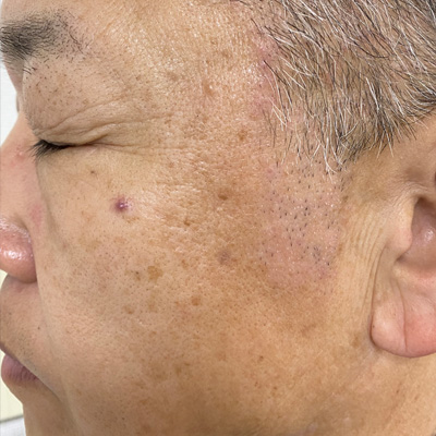 Dr.PUR BEAUTEご利用前